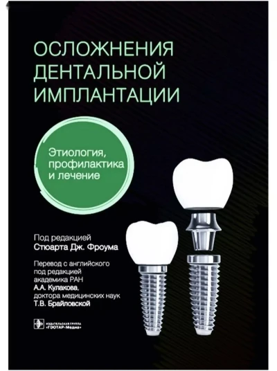 Книга Осложнения дентальной имплантации на заказ