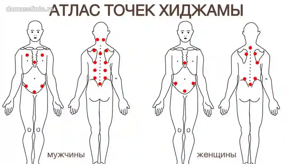 Хиджама
