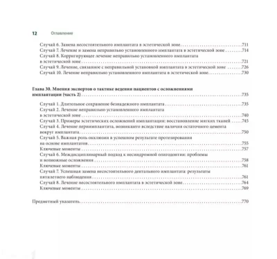 Книга Осложнения дентальной имплантации на заказ
